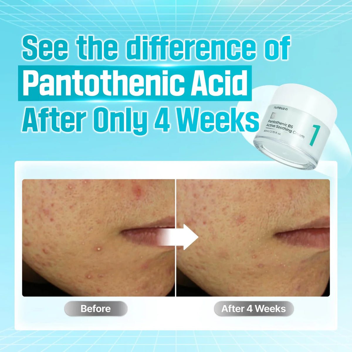 NUMBUZIN No.1 Pantothenic B5 Active Soothing Cream 80ml